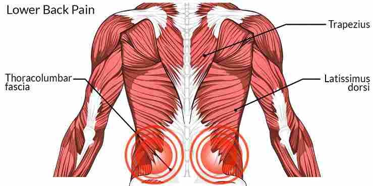Back Pain Causes and Natural Relief Tips for Long-Term Recovery