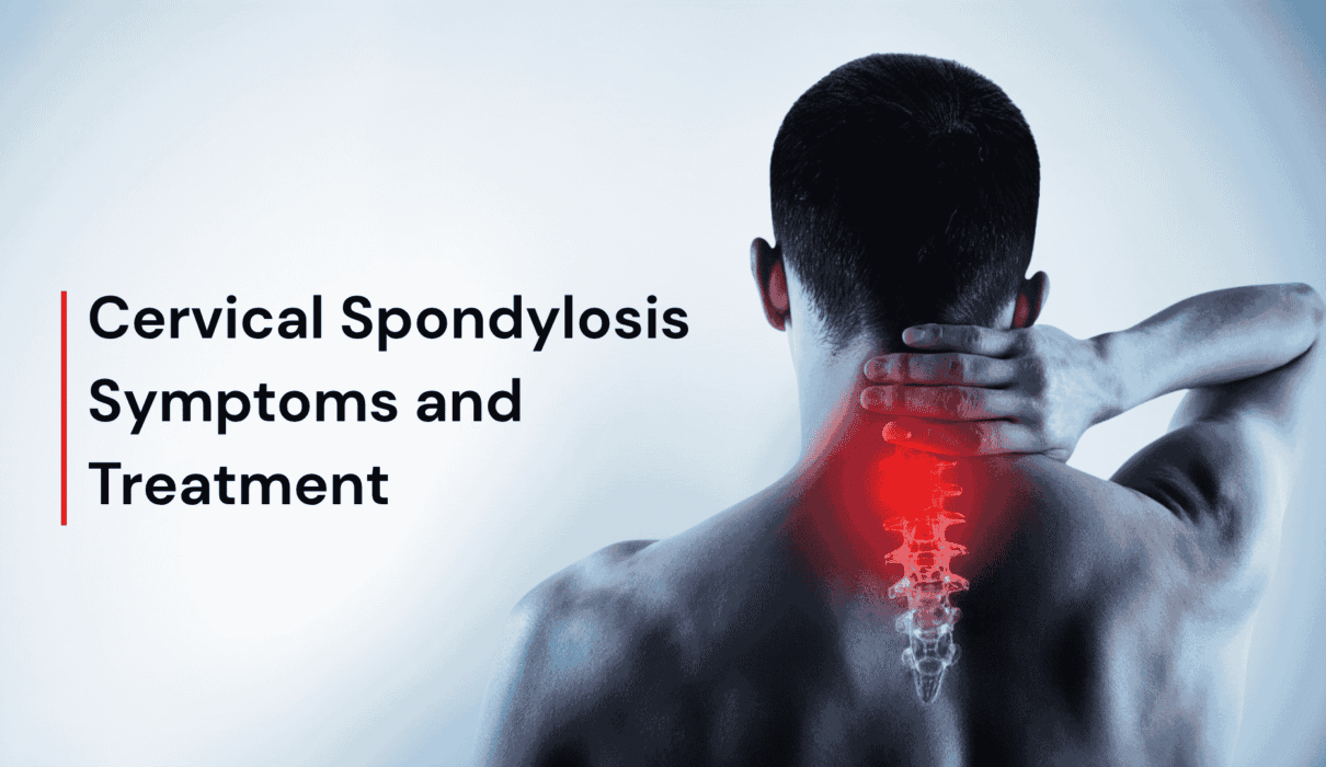 Neck Pain Problem? It Could Be Cervical Spondylosis - Symptoms and Treatment 1 Neck Pain Problem? It Could Be Cervical Spondylosis - Symptoms and Treatment
